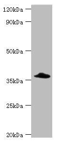 CFHR3 antibody