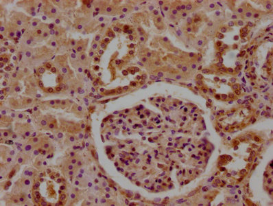 CFHR5 antibody