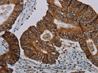 CFLAR Antibody