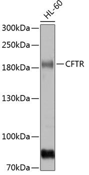 CFTR antibody