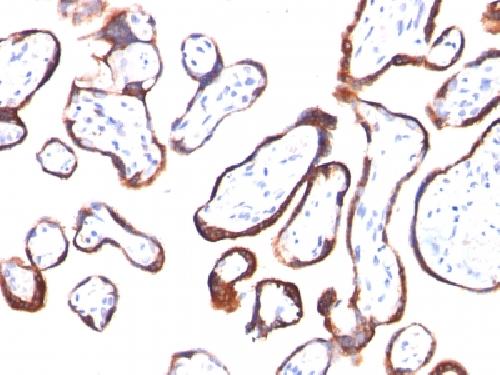 HCG-beta (Pregnancy & Choriocarcinoma Marker) Antibody