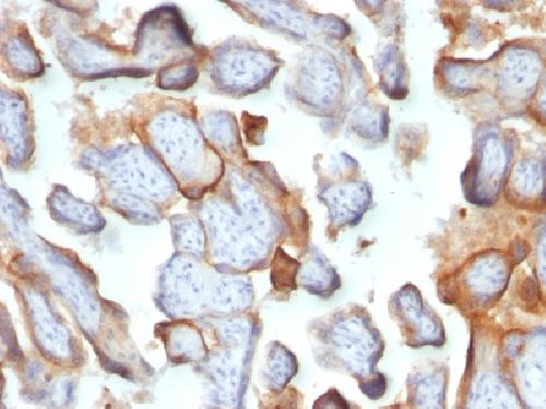 HCG-beta (Pregnancy & Choriocarcinoma Marker) Antibody