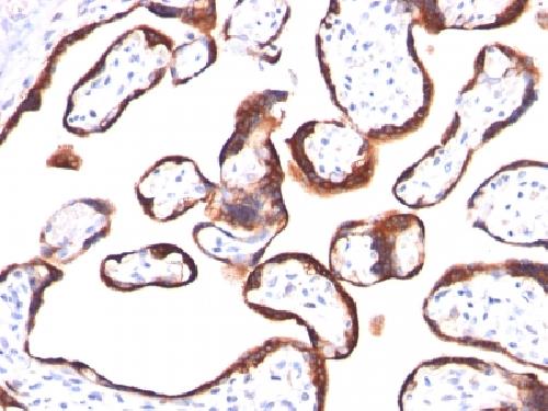 HCG-beta (Pregnancy & Choriocarcinoma Marker) Antibody