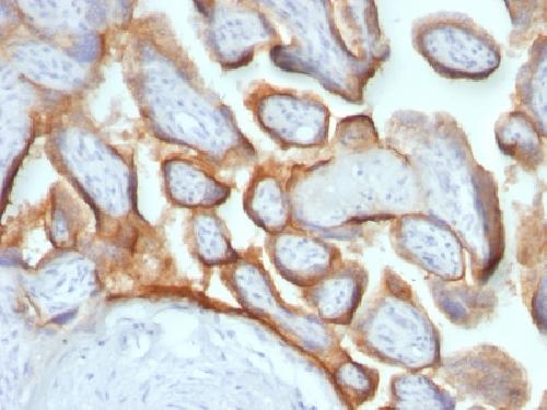 HCG-beta (Pregnancy & Choriocarcinoma Marker) Antibody