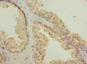 CGGBP1 Antibody