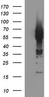 CGI 62 (ZC2HC1A) antibody