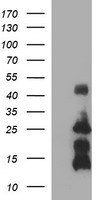 CGI 62 (ZC2HC1A) antibody