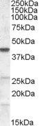 Goat anti-CGI58 / ABHD5 Antibody