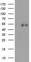 cGKI (PRKG1) antibody