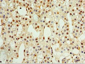 CALCB Antibody