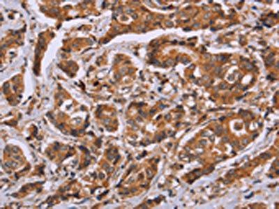 CALCA Antibody