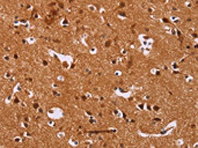 CALCA Antibody