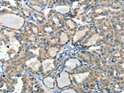 CALCA Antibody