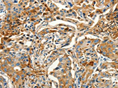 CALCA Antibody
