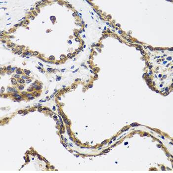 CALCB polyclonal antibody