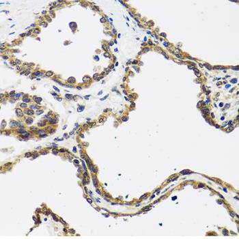 CGRP antibody