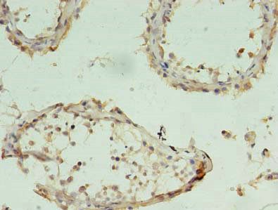 CHAC1 Antibody