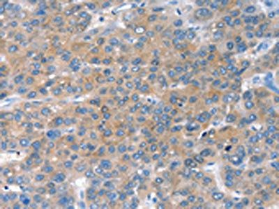 CHAC1 Antibody