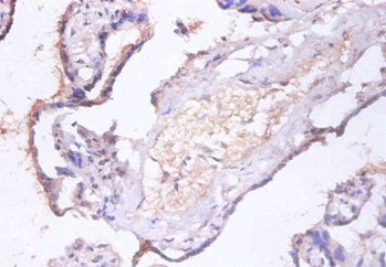 CHMP2A Antibody