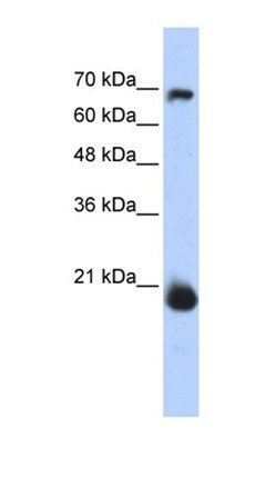 CHCHD4 antibody