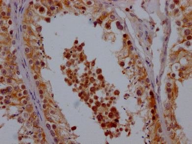 CHCHD5 Antibody