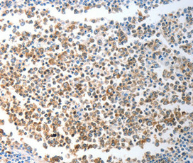 CHD5 antibody