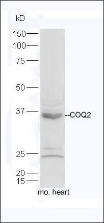 CHD6 antibody