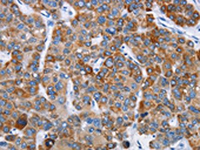CHDH Antibody