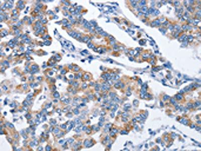 CHDH Antibody