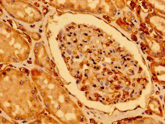CHDH Antibody