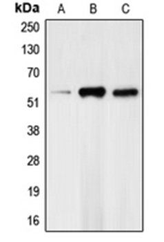 CHEK1 (phospho-S317) antibody