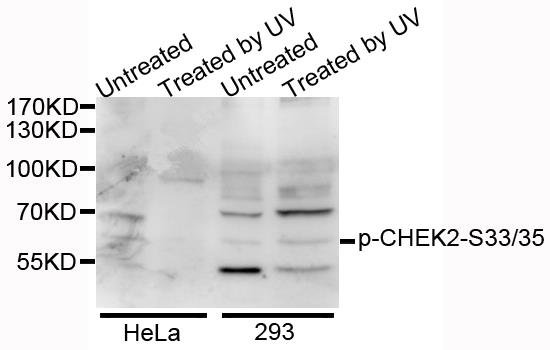 CHEK2 (Phospho-S33/35) antibody