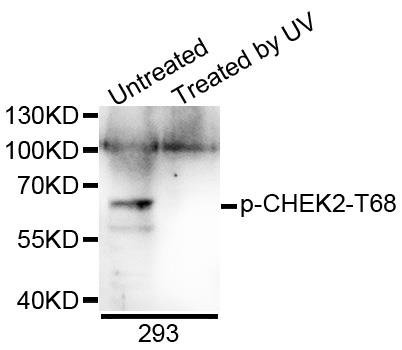 CHEK2 (Phospho-T68) antibody