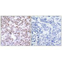 CHEK2 (Ab-68) Antibody