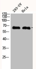 CHEK2 Antibody