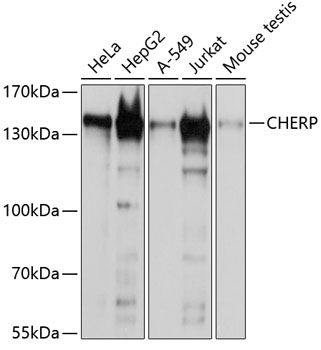 CHERP antibody