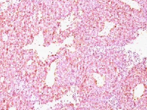 Chromogranin A / CHGA (Neuroendocrine Marker) Antibody