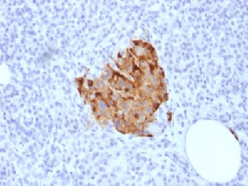 Recombinant Chromogranin A / CHGA (Neuroendocrine Marker) Antibody