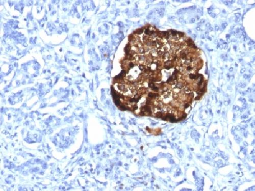 Recombinant Chromogranin A / CHGA (Neuroendocrine Marker) Antibody