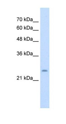 CHIC1 antibody