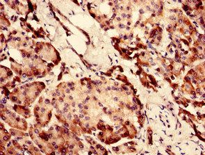 CHID1 Antibody