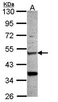 Chitotriosidase antibody
