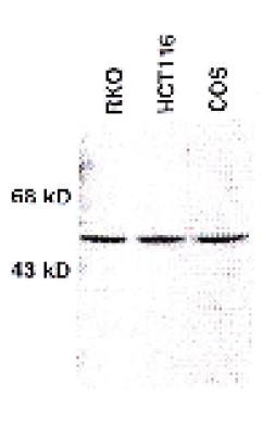 chk 1 kinase antibody