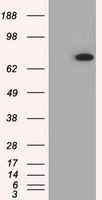 Chk2 (CHEK2) antibody