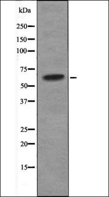 CHK2 (Phospho-Ser33+Ser35) antibody