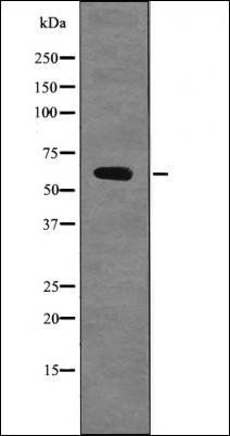 Chk2 (Phospho-Ser379) antibody