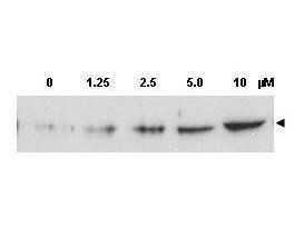 CHK2 (phospho-T68) antibody