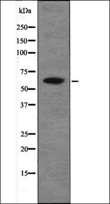 Chk2 (Phospho-Thr26+Ser28) antibody
