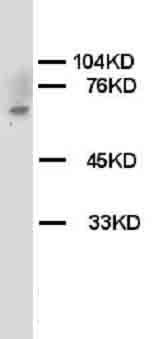 Anti-Chk2/CHEK2 Antibody