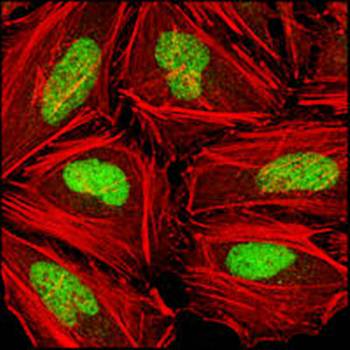 CHK2 Antibody